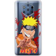 Прозрачный чехол Uprint Nokia 9 Naruto