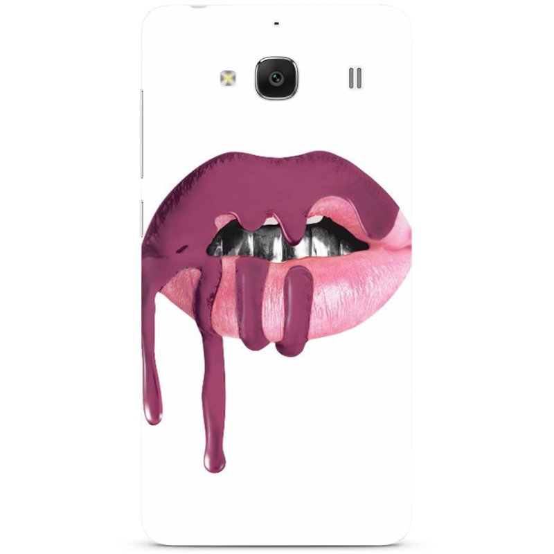 Чехол Uprint Xiaomi Redmi 2 