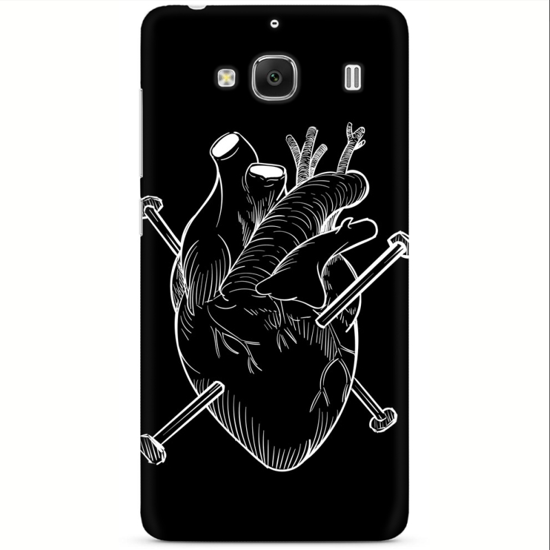 Чехол Uprint Xiaomi Redmi 2 