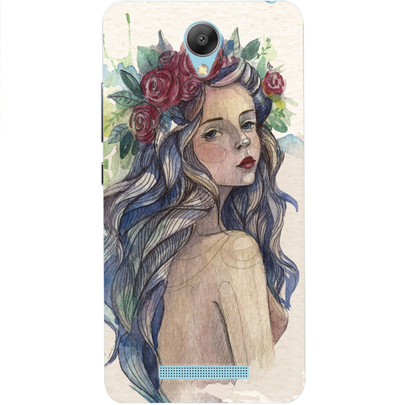 Чехол Uprint Xiaomi Redmi Note 2 