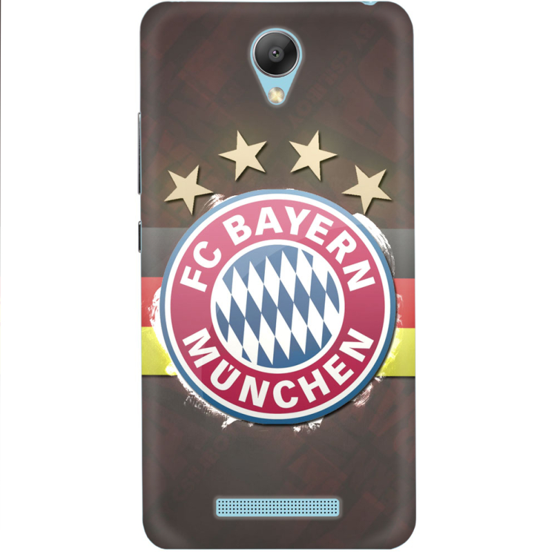 Чехол Uprint Xiaomi Redmi Note 2 