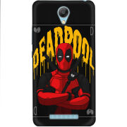 Чехол Uprint Xiaomi Redmi Note 2 