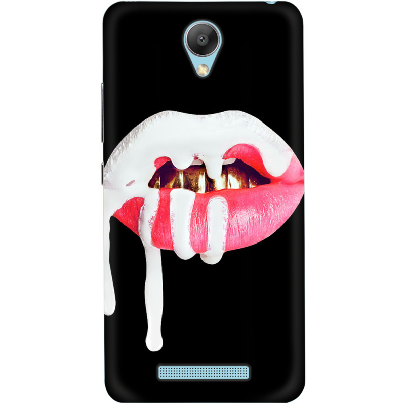 Чехол Uprint Xiaomi Redmi Note 2 