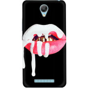 Чехол Uprint Xiaomi Redmi Note 2 