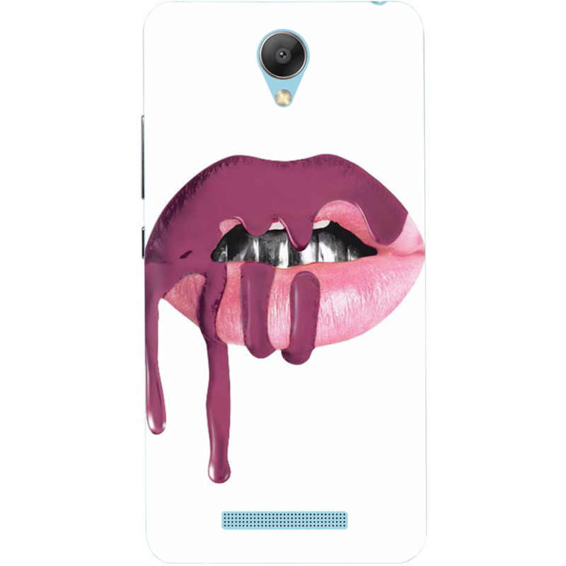 Чехол Uprint Xiaomi Redmi Note 2 