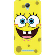 Чехол Uprint Xiaomi Redmi Note 2 