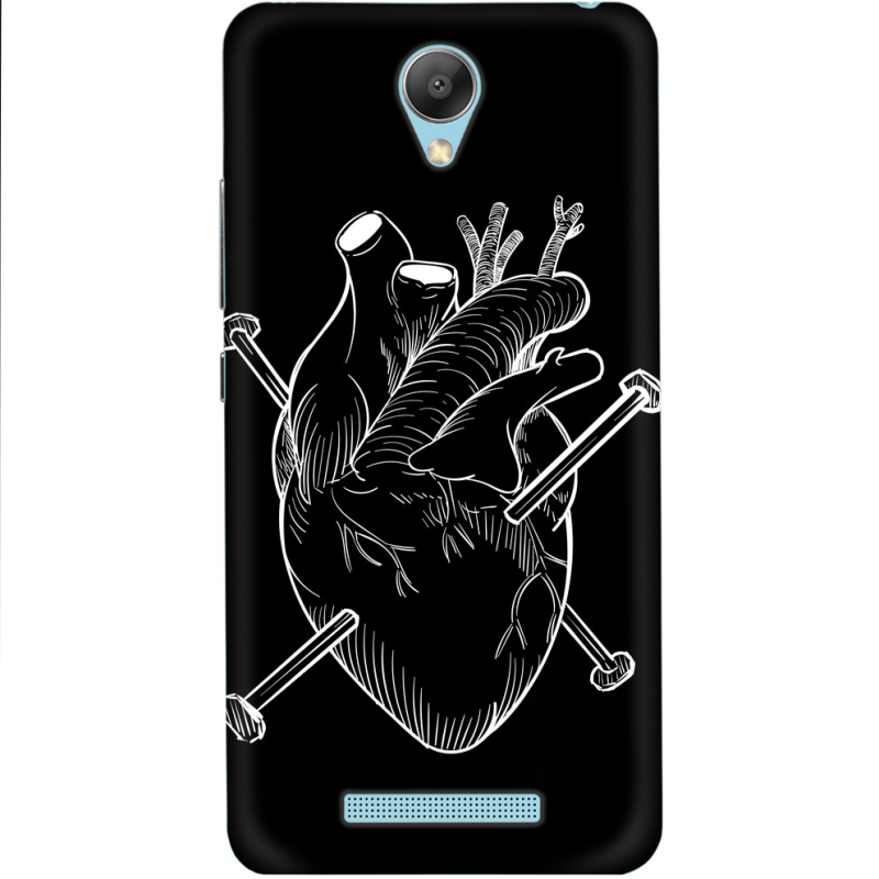 Чехол Uprint Xiaomi Redmi Note 2 