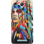 Чехол Uprint Xiaomi Redmi Note 2 