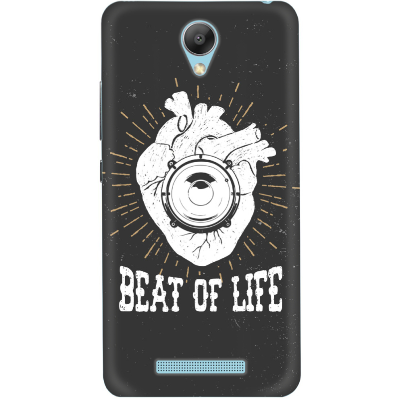 Чехол Uprint Xiaomi Redmi Note 2 