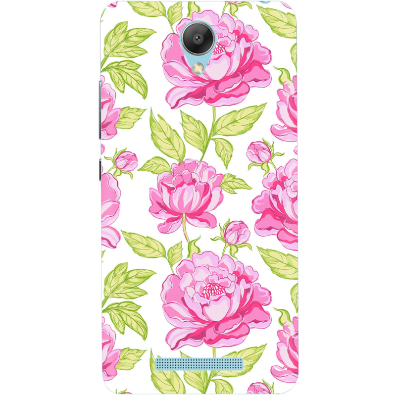 Чехол Uprint Xiaomi Redmi Note 2 