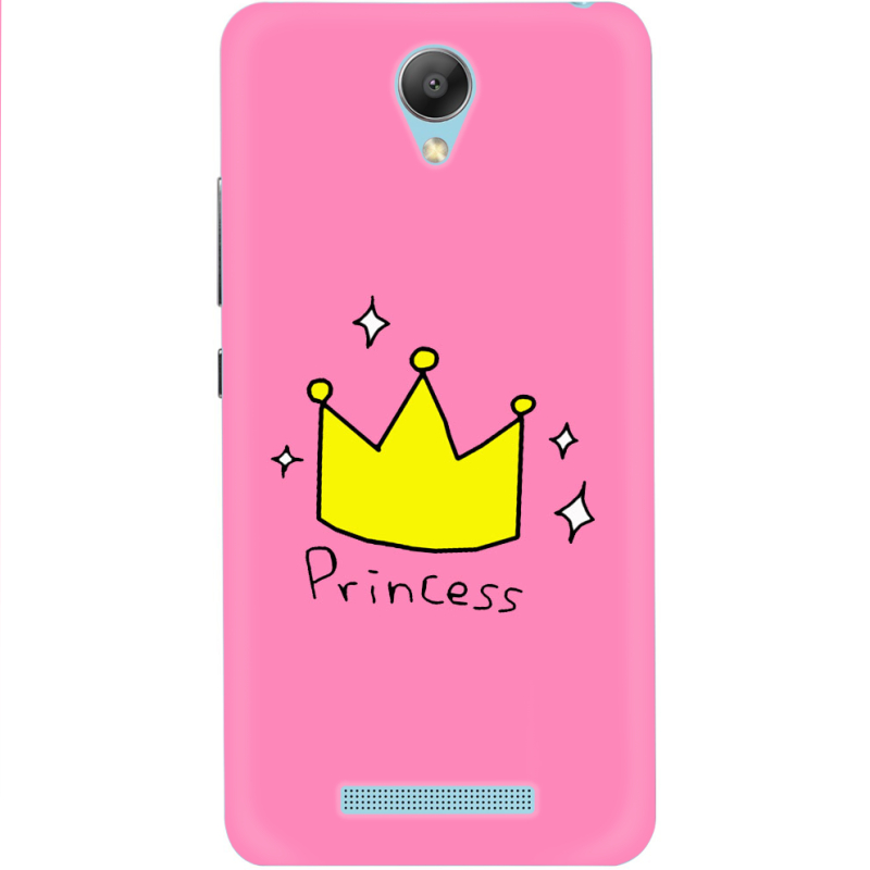 Чехол Uprint Xiaomi Redmi Note 2 