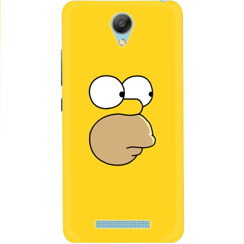 Чехол Uprint Xiaomi Redmi Note 2 