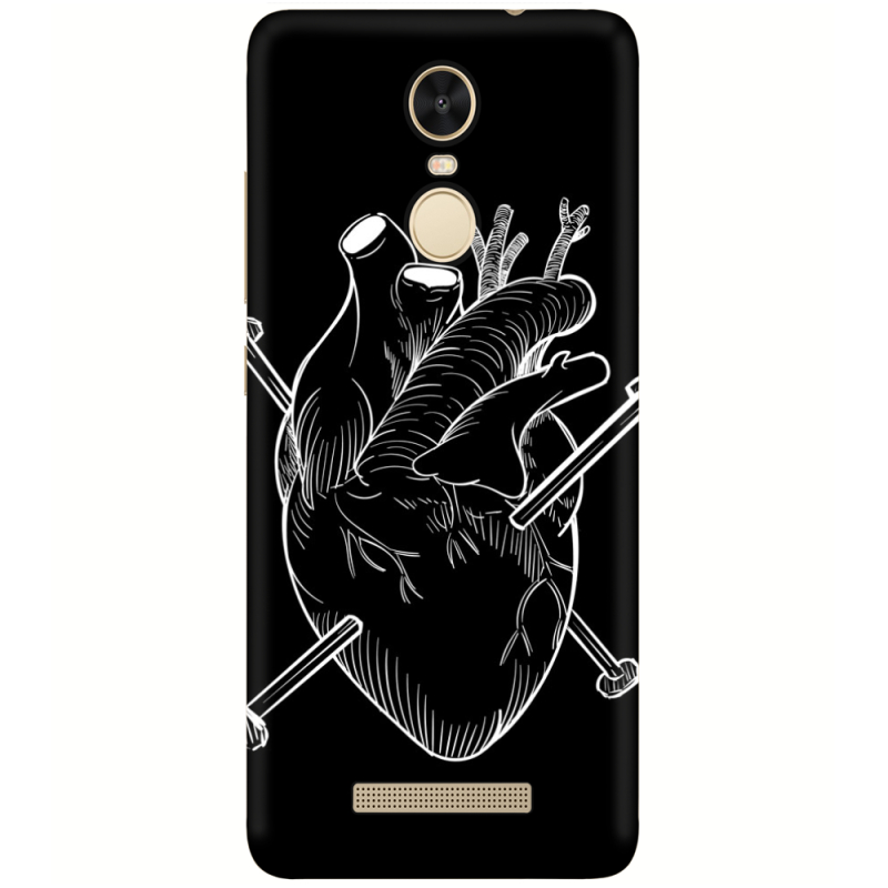 Чехол Uprint Xiaomi Redmi Note 3 / Note 3 Pro 