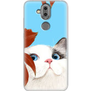 Чехол Uprint Nokia 8.1 Wondering Cat