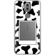 Прозрачный чехол Uprint Nokia 8.1 Cow