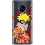 Прозрачный чехол Uprint Vivo Nex 3 Naruto