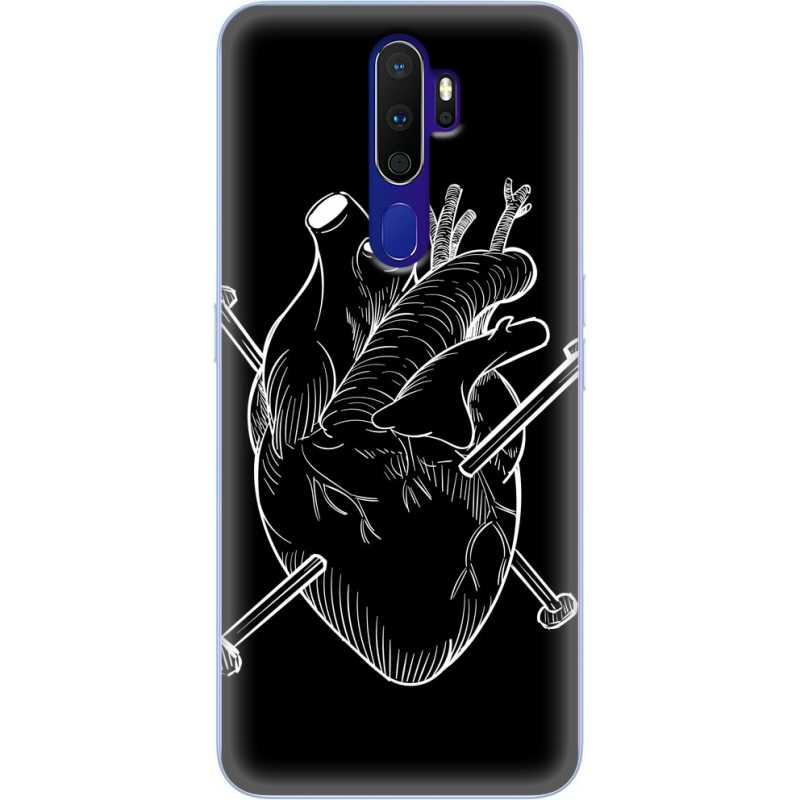 Чехол Uprint OPPO A9 2020 