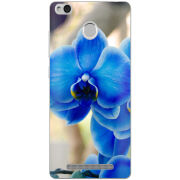 Чехол Uprint Xiaomi Redmi 3S / 3S Pro 