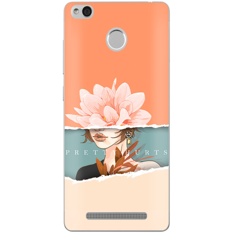 Чехол Uprint Xiaomi Redmi 3S / 3S Pro 