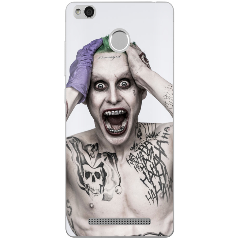 Чехол Uprint Xiaomi Redmi 3S / 3S Pro 