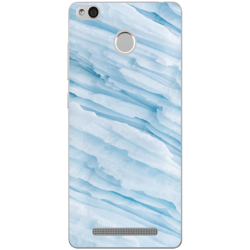 Чехол Uprint Xiaomi Redmi 3S / 3S Pro 