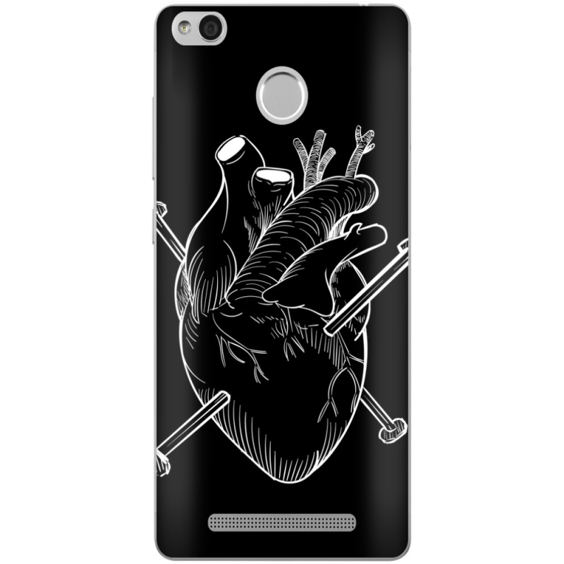 Чехол Uprint Xiaomi Redmi 3S / 3S Pro 