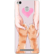 Чехол Uprint Xiaomi Redmi 3S / 3S Pro 