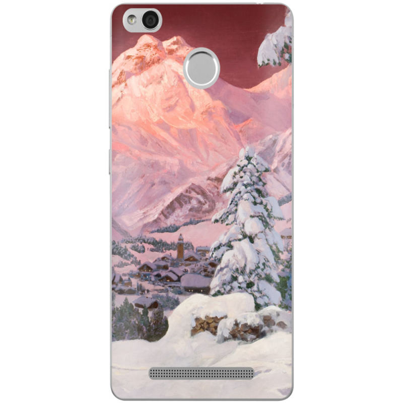 Чехол Uprint Xiaomi Redmi 3S / 3S Pro 