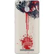 Чехол Uprint Xiaomi Redmi 3S / 3S Pro 