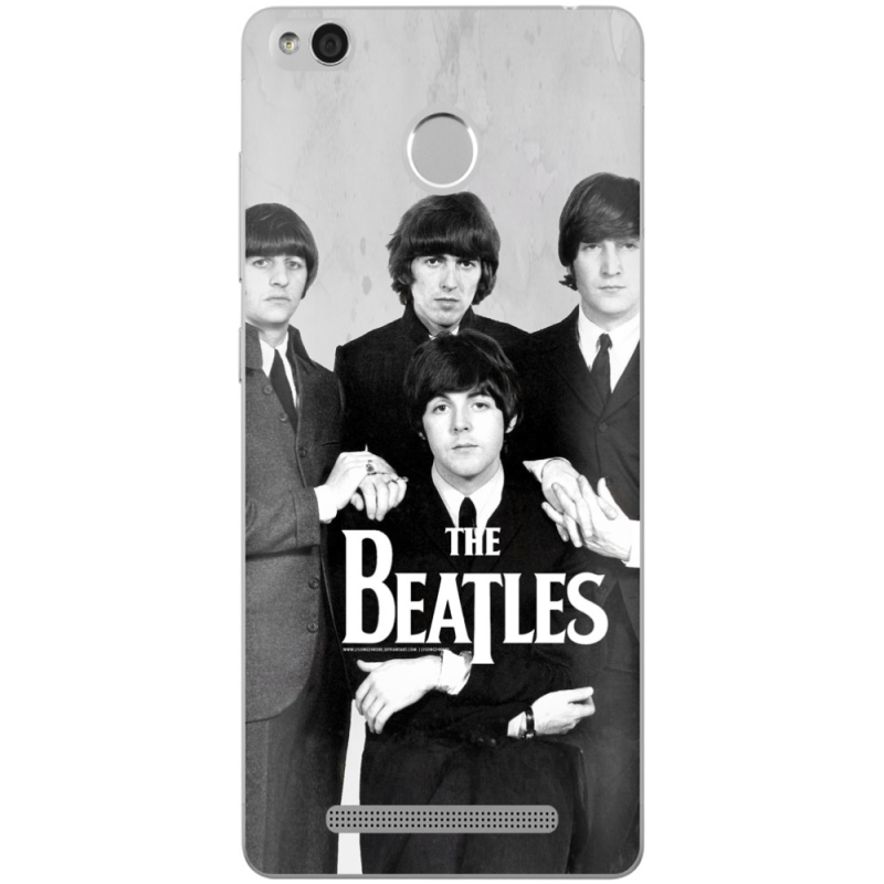 Чехол Uprint Xiaomi Redmi 3S / 3S Pro 