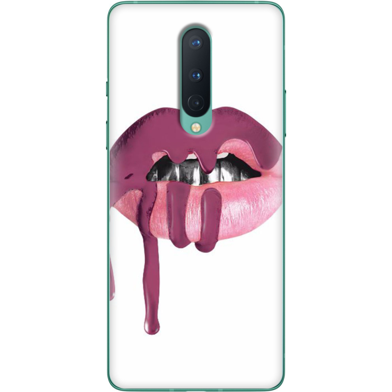 Чехол BoxFace OnePlus 8 