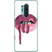 Чехол BoxFace OnePlus 8 Pro 