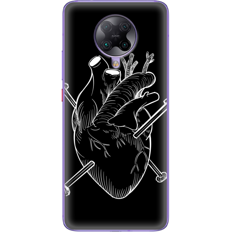 Чехол BoxFace Poco F2 Pro 