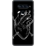 Чехол BoxFace LG V40 ThinQ 