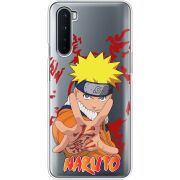 Прозрачный чехол BoxFace OnePlus Nord Naruto