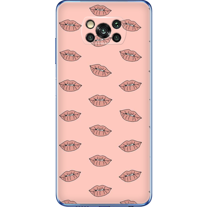 Чехол BoxFace Poco X3 