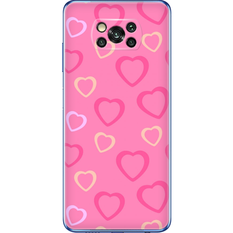 Чехол BoxFace Poco X3 Sugar Hearts