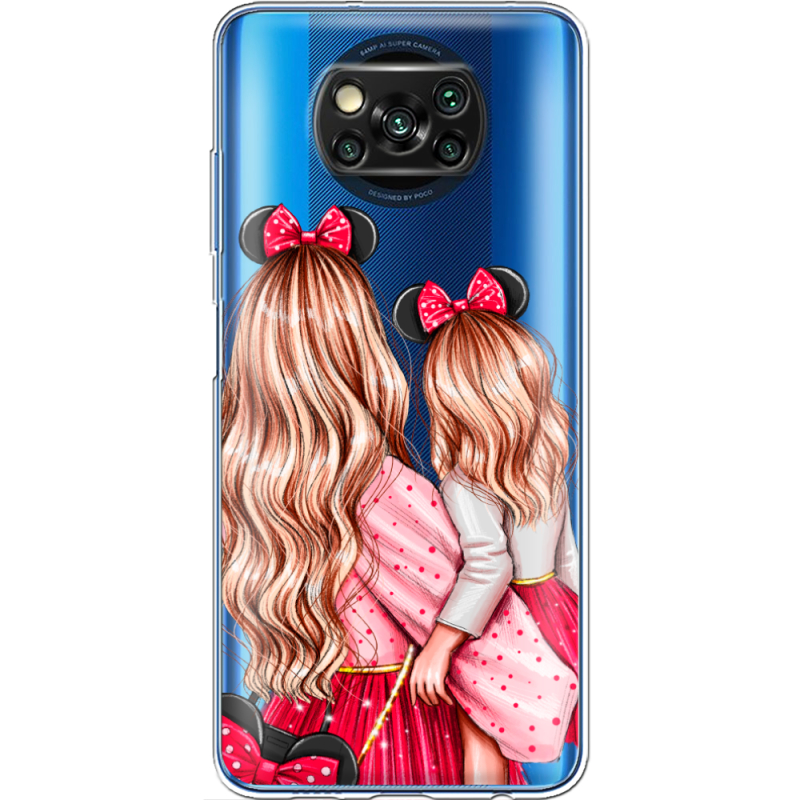 Прозрачный чехол BoxFace Xiaomi Poco X3 Mouse Girls