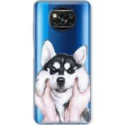 Прозрачный чехол BoxFace Xiaomi Poco X3 Husky