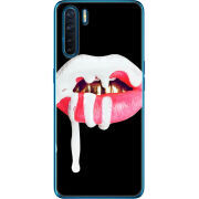 Чехол BoxFace OPPO A91 