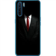 Чехол BoxFace OPPO A91 