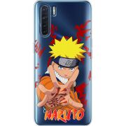 Прозрачный чехол BoxFace OPPO A91 Naruto