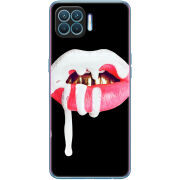 Чехол BoxFace OPPO A93/ Reno 4 Lite 