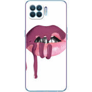 Чехол BoxFace OPPO Reno4 Lite/ A93 