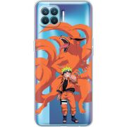 Прозрачный чехол BoxFace OPPO Reno4 Lite/ A93 Naruto and Kurama