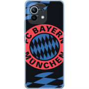 Чехол BoxFace Xiaomi Mi 11 FC Bayern