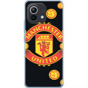 Чехол BoxFace Xiaomi Mi 11 FC Manchester-U