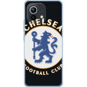 Чехол BoxFace Xiaomi Mi 11 FC Chelsea