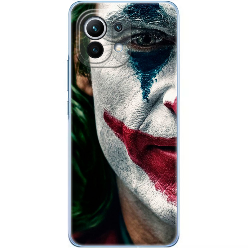 Чехол BoxFace Xiaomi Mi 11 Joker Background