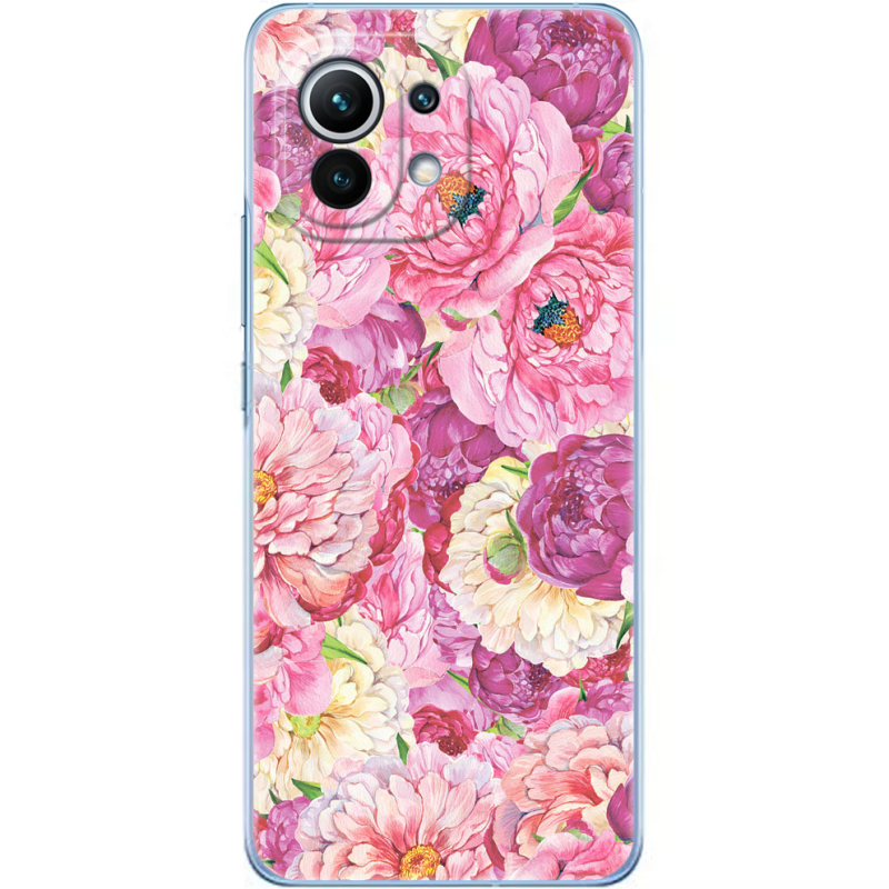 Чехол BoxFace Xiaomi Mi 11 Pink Peonies